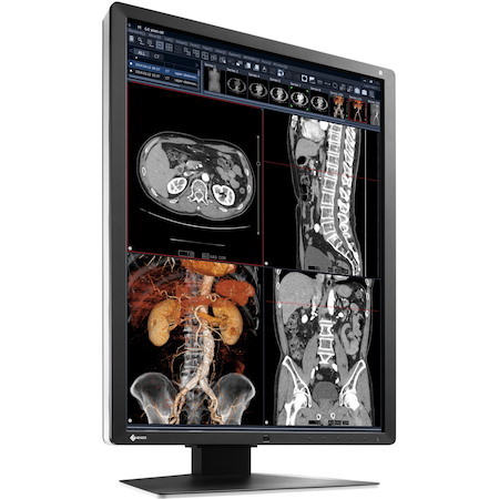 EIZO RadiForce RX250 22" Class LCD Monitor - 3:4 - Black
