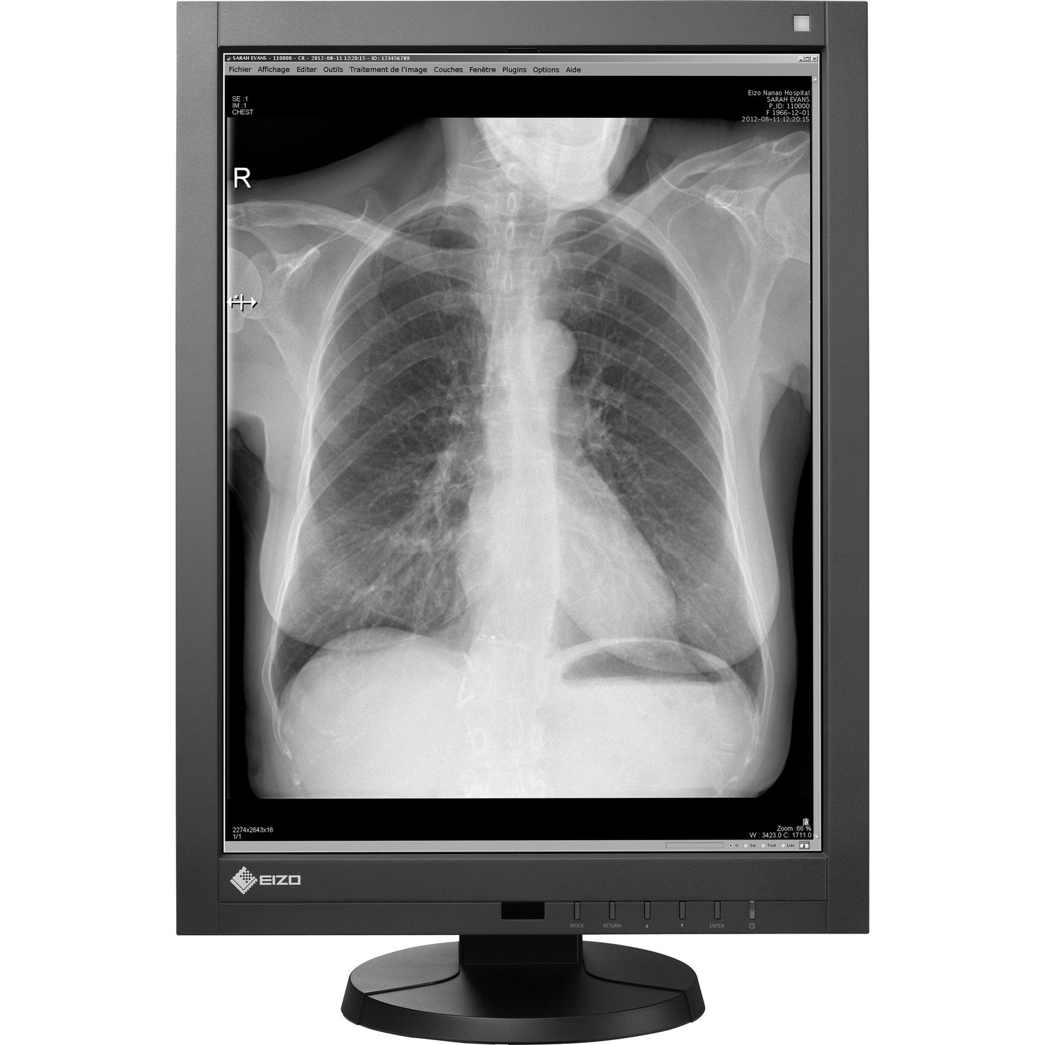 EIZO RadiForce QXGA LCD Monitor - Black